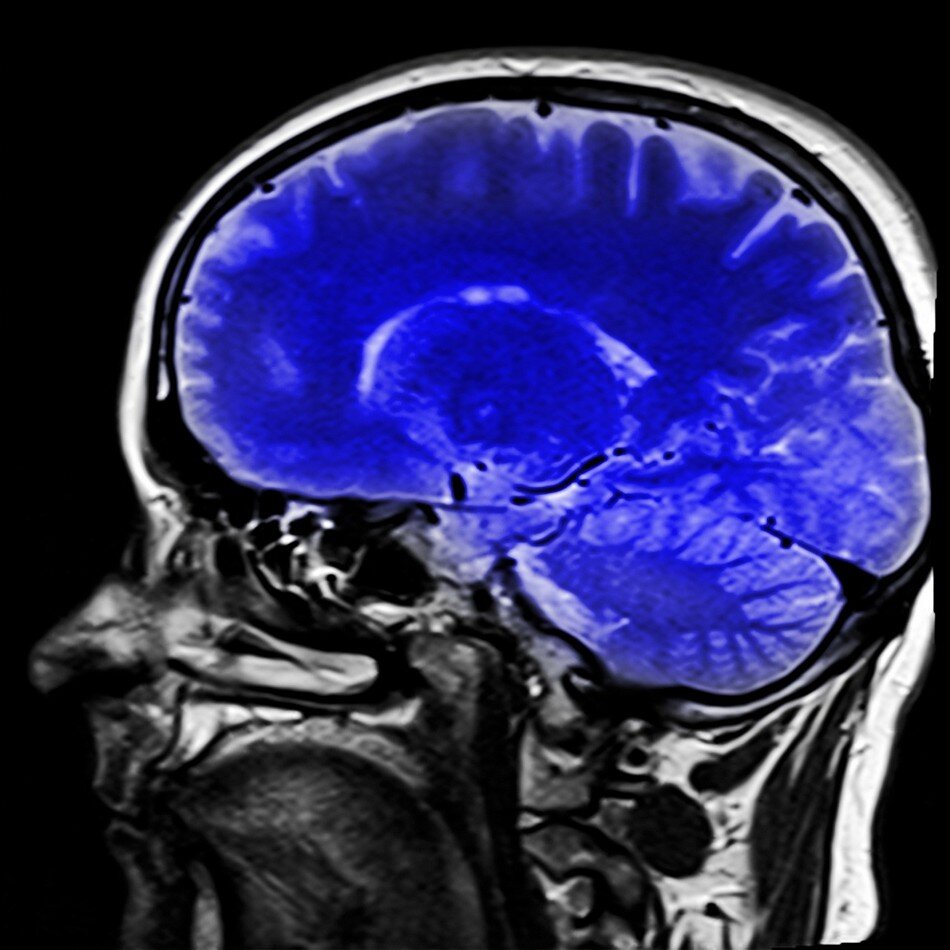 Imagen de la cabeza generada por resonancia magnética